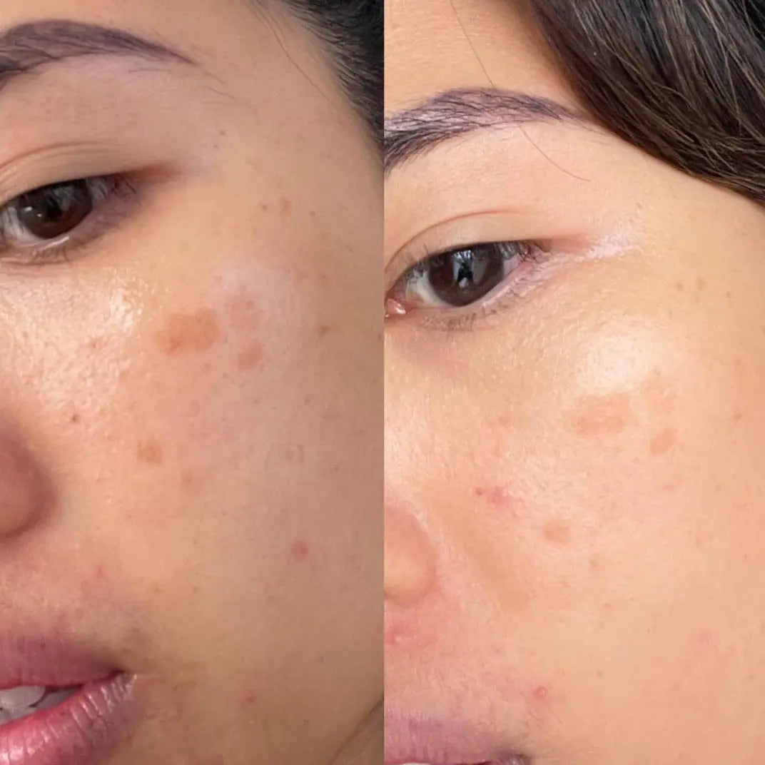 Vitamin C Booster Treatment