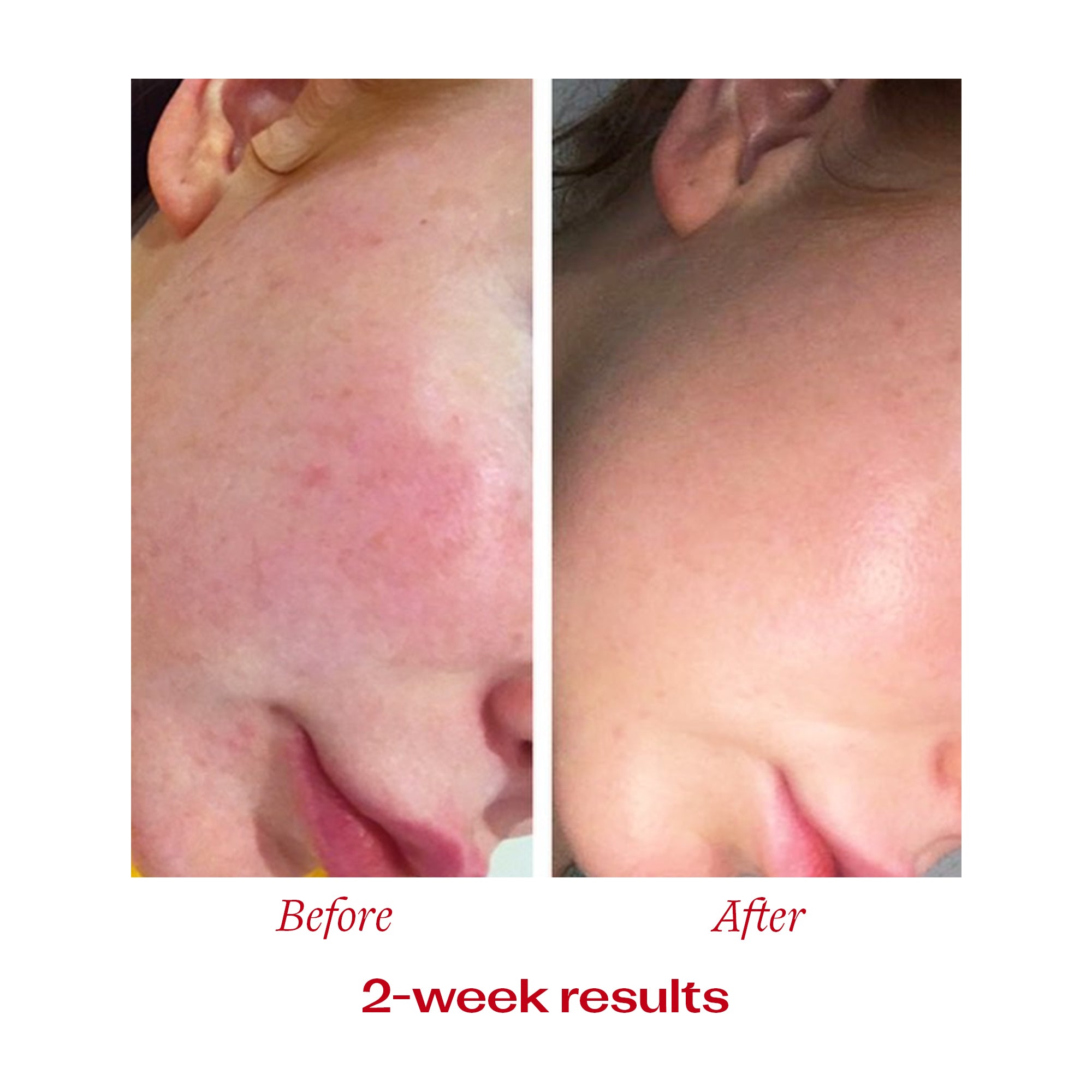 Vitamin C Booster Treatment, 0.51 fl oz