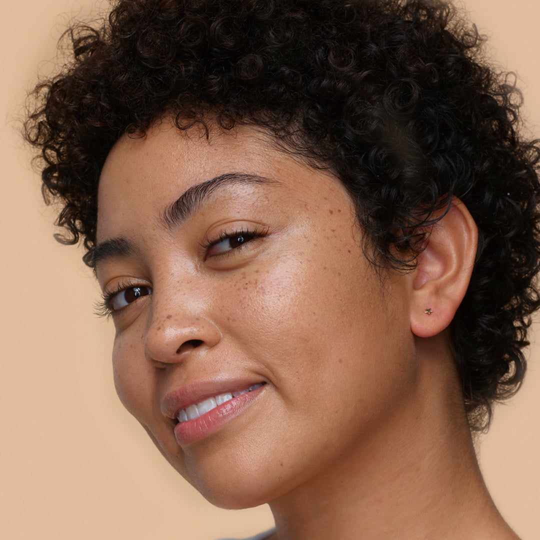 What is hyperpigmentation? (and what can we do about it)