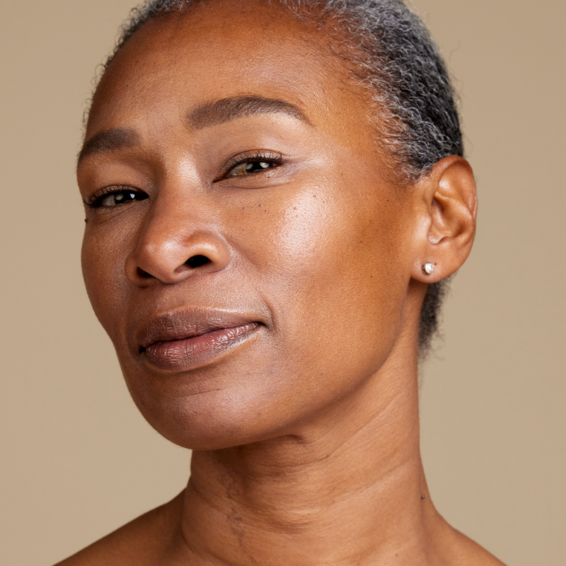 Aging skin